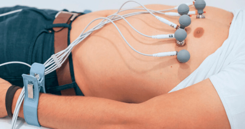 Eletrocardiograma